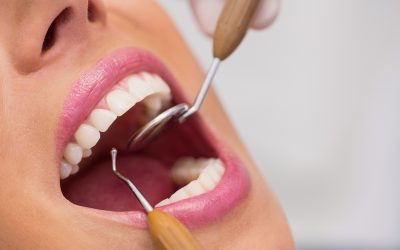 Mitos y verdades sobre la salud dental